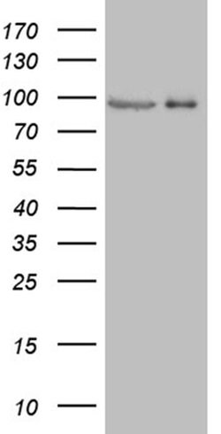 PRKG2 Monoclonal Antibody (OTI10D5), TrueMAB , OriGene 100 &mu;L; Unconjugated:Antibodies,