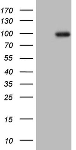 PRKG2 Mouse anti-Human, Clone: OTI15E6, lyophilized, TrueMAB 100 &mu;g;