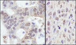 PRKRIR Rabbit anti-Human, Mouse, Polyclonal, Bethyl Laboratories 100 &mu;L;