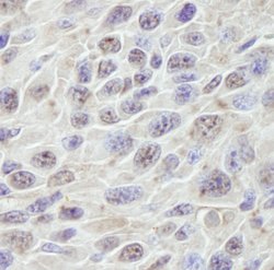 PRKRIR Polyclonal Antibody, Bethyl Laboratories 10 &mu;L | Buy Online | Bethyl Laboratories, Inc | Fisher Scientific