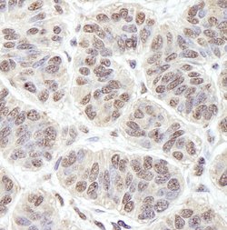 PRKRIR Polyclonal Antibody, Bethyl Laboratories 10 &mu;L | Buy Online | Bethyl Laboratories, Inc | Fisher Scientific
