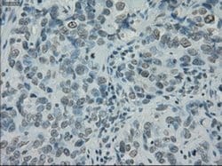 PRKY Mouse anti-Human, Clone: OTI5E9, liquid, TrueMAB 100 &mu;L; Unconjugated:Antibodies,