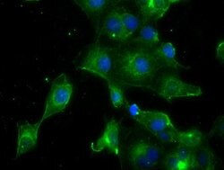 PRL Mouse anti-Human, Clone: OTI6B1, lyophilized, TrueMAB 100 &mu;g; Unconjugated:Antibodies,