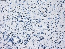 PRL Mouse anti-Human, Clone: OTI6B1, lyophilized, TrueMAB 100 &mu;g; Unconjugated:Antibodies,