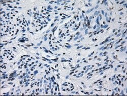 PRL Mouse anti-Human, Clone: OTI6B1, lyophilized, TrueMAB 100 &mu;g; Unconjugated:Antibodies,