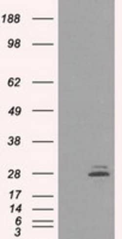 PRL Mouse anti-Human, Clone: OTI6B1, lyophilized, TrueMAB 100 &mu;g; Unconjugated:Antibodies,