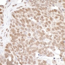 PRMT1 Rabbit anti-Human, Mouse, Polyclonal, Bethyl Laboratories 100 &mu;L;