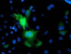 PRMT2 Mouse anti-Human, Clone: OTI3B3, lyophilized, TrueMAB 100 &mu;g;