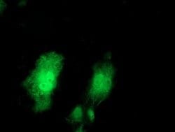 PRMT2 Monoclonal Antibody (OTI5E11), TrueMAB , OriGene 100 &mu;L; Unconjugated:Antibodies,
