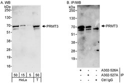 PRMT3 Rabbit anti-Human, Polyclonal, Bethyl Laboratories 100 &mu;l; Unlabeled:Antibodies,