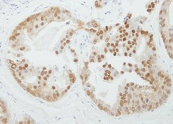 PRMT5 Rabbit anti-Human, Polyclonal, Bethyl Laboratories 100 &mu;L; Unconjugated:Antibodies,