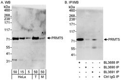 PRMT5 Rabbit anti-Human, Polyclonal, Bethyl Laboratories 100 &mu;L; Unconjugated:Antibodies,