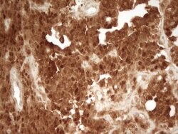 PRMT5 Monoclonal Antibody (OTI2C12), TrueMAB , OriGene 100 &mu;L; Unconjugated:Antibodies,