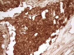 PRMT5 Monoclonal Antibody (OTI2C12), TrueMAB , OriGene 100 &mu;L; Unconjugated:Antibodies,