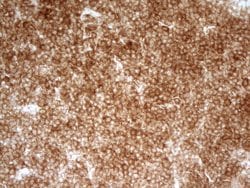 PRMT5 Monoclonal Antibody (OTI2C12), TrueMAB , OriGene 100 &mu;L; Unconjugated:Antibodies,