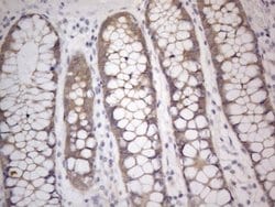 PRMT5 Mouse anti-Human, Clone: OTI2H3, lyophilized, TrueMAB 100 &mu;g;