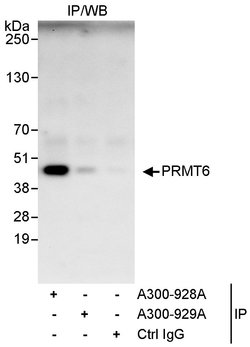 PRMT6 Rabbit anti-Human, Polyclonal, Bethyl Laboratories 100 &mu;L; Unconjugated:Antibodies,