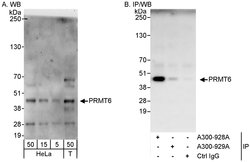 PRMT6 Rabbit anti-Human, Polyclonal, Bethyl Laboratories 100 &mu;l; Unlabeled:Antibodies,