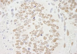 PRMT6 Polyclonal Antibody, Bethyl Laboratories 100 &mu;L; Unconjugated:Antibodies,