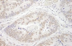 PRMT6 Polyclonal Antibody, Bethyl Laboratories 100 &mu;L; Unconjugated:Antibodies,