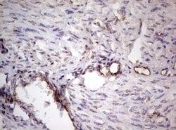 PROCR Monoclonal Antibody (OTI9E11), TrueMAB , OriGene 100 &mu;L; Unconjugated:Antibodies,