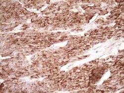 PROCR Monoclonal Antibody (OTI3E7), TrueMAB , OriGene 100 &mu;L; Unconjugated:Antibodies,