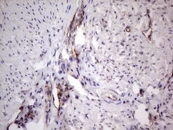 PROCR Mouse anti-Human, Clone: OTI13E1, lyophilized, TrueMAB 100 &mu;g;
