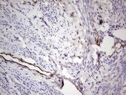 PROCR Mouse anti-Human, Clone: OTI13E1, lyophilized, TrueMAB 100 &mu;g;