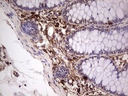 PROCR Mouse anti-Human, Clone: OTI13E1, lyophilized, TrueMAB 100 &mu;g;