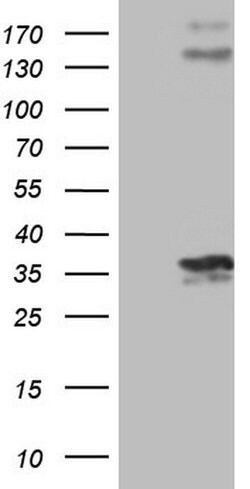PROCR Monoclonal Antibody (OTI9E11), TrueMAB , OriGene 100 &mu;L; Unconjugated:Antibodies,
