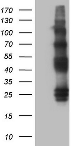 PROCR Monoclonal Antibody (OTI2G2), TrueMAB , OriGene 100 &mu;L | Buy Online | OriGene | Fisher Scientific