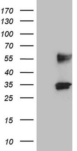 PROCR Monoclonal Antibody (OTI6B10), TrueMAB , OriGene:Antibodies:Primary