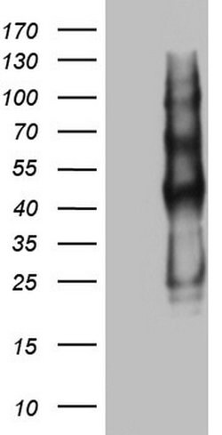 PROCR Monoclonal Antibody (OTI12C4), TrueMAB , OriGene 100 &mu;L | Buy Online | Origene Technologies | Fisher Scientific