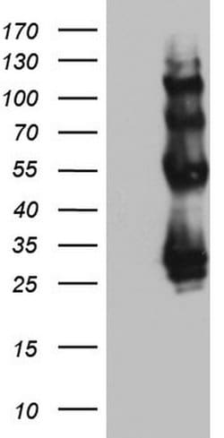 PROCR Monoclonal Antibody (OTI1H10), TrueMAB , OriGene 100 &mu;L | Buy Online | Origene Technologies | Fisher Scientific