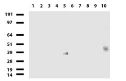PROCR Mouse anti-Human, Clone: UMAB201, liquid, UltraMAB 100 &mu;L | Buy Online | Origene Technologies | Fisher Scientific