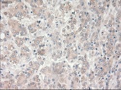 PROM2 Mouse anti-Human, Clone: OTI14D1, lyophilized, TrueMAB 100 &mu;g;