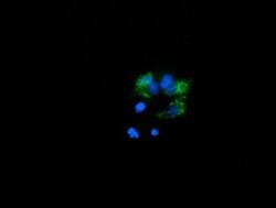 PROSC Monoclonal Antibody (OTI1G2), TrueMAB , OriGene 100 &mu;L | Buy Online | OriGene | Fisher Scientific