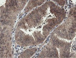 PROSC Mouse anti-Human, Clone: OTI3G7, lyophilized, TrueMAB 100 &mu;g;
