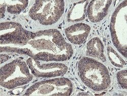 PROSC Mouse anti-Human, Clone: OTI3G7, lyophilized, TrueMAB 100 &mu;g;