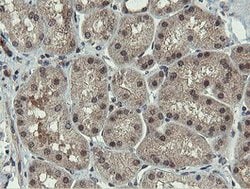 PROSC Mouse anti-Human, Clone: OTI3G7, lyophilized, TrueMAB 100 &mu;g;