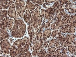 PROSC Monoclonal Antibody (OTI1G2), TrueMAB , OriGene 100 &mu;L | Buy Online | OriGene | Fisher Scientific