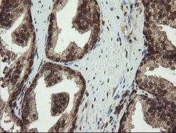PROSC Mouse anti-Human, Clone: OTI3A6, lyophilized, TrueMAB 100 &mu;g;