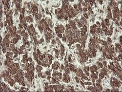 PROSC Monoclonal Antibody (OTI3A6), TrueMAB , OriGene 30 &mu;L; Unconjugated:Antibodies,