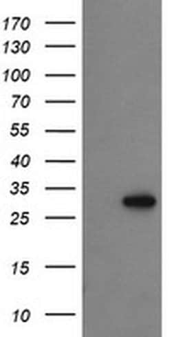 PROSC Monoclonal Antibody (OTI1G2), TrueMAB , OriGene 100 &mu;L | Buy Online | OriGene | Fisher Scientific