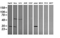 PROSC Monoclonal Antibody (OTI1G2), TrueMAB , OriGene 100 &mu;L | Buy Online | OriGene | Fisher Scientific