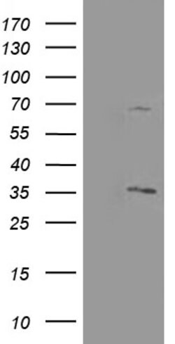 PROSC Mouse anti-Human, Clone: OTI3A6, lyophilized, TrueMAB 100 &mu;g;