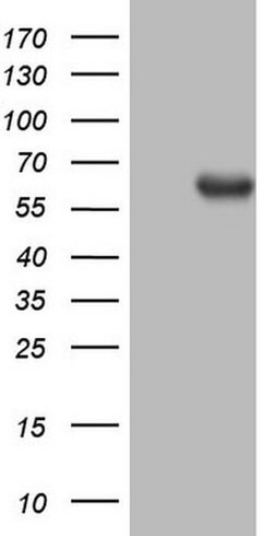 PROZ Monoclonal Antibody (OTI3A11), TrueMAB , OriGene 100 &mu;L; Unconjugated:Antibodies,