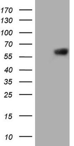 PROZ Mouse anti-Human, Clone: OTI4F1, lyophilized, TrueMAB 100 &mu;g; Unconjugated:Antibodies,