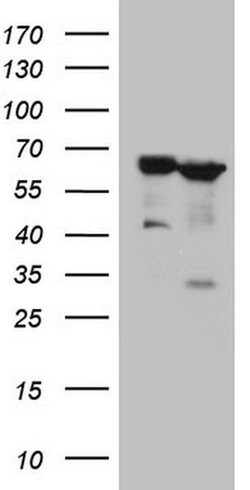 PROZ Monoclonal Antibody (OTI3E5), TrueMAB , OriGene 100 &mu;L; Unconjugated:Antibodies,