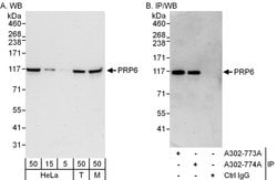 PRP6 Rabbit anti-Human, Mouse, Polyclonal, Bethyl Laboratories 100 &mu;l;